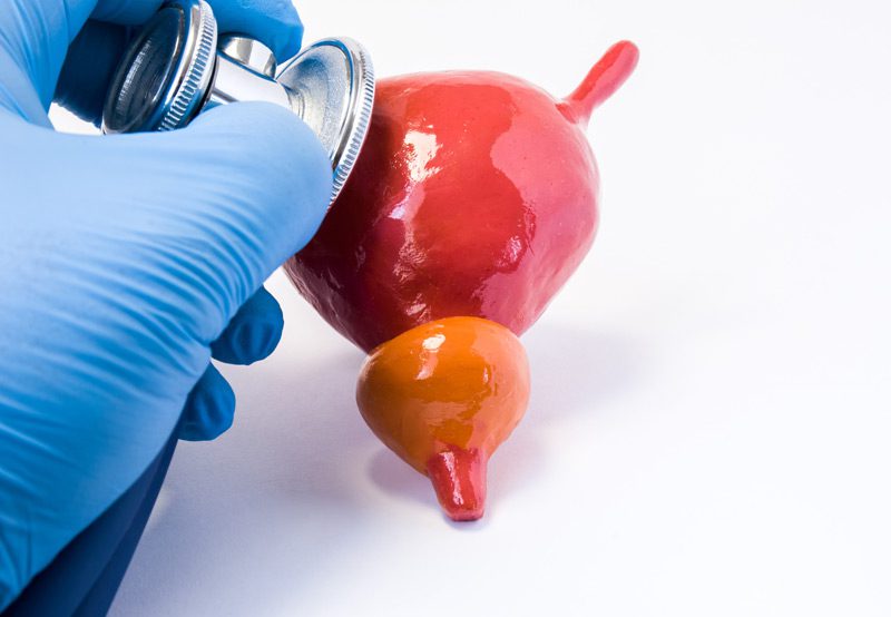 Doctor-holding-a-stethoscope-to-a-model-of-the-bladder